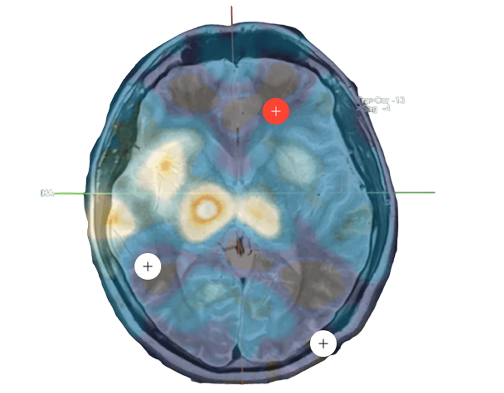 Brain scan research imagery